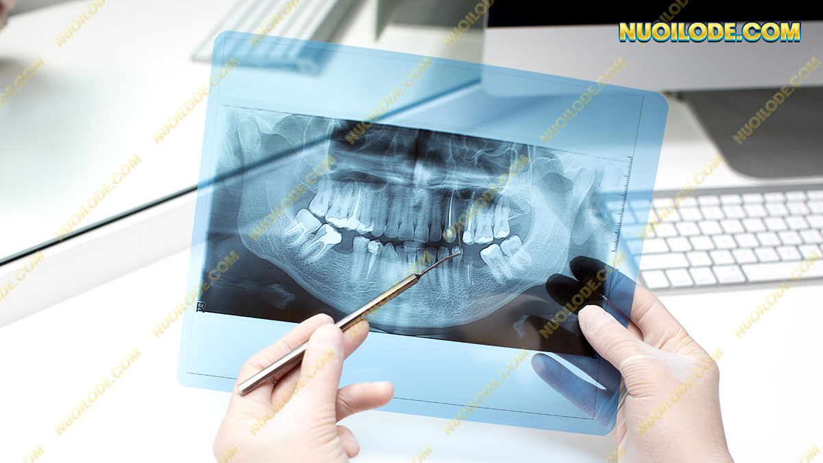 Giải mã một số giấc mơ thấy rụng răng thường gặp