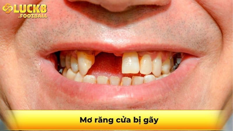 Mơ răng cửa bị gãy