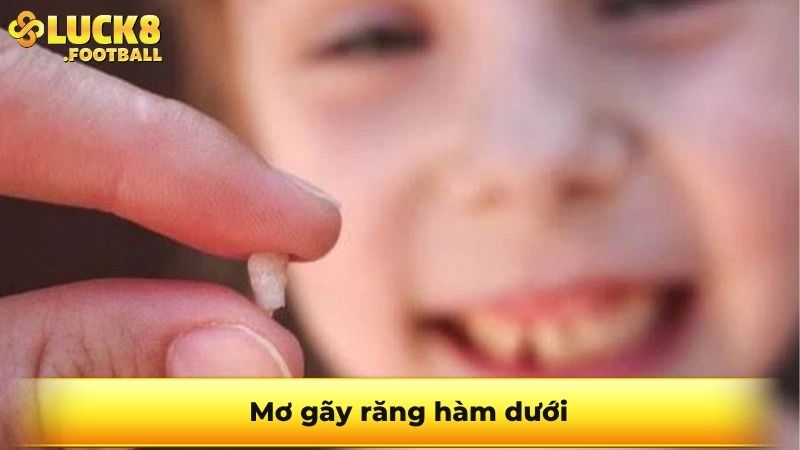 Mơ gãy răng hàm dưới