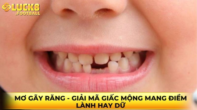 Mơ gãy răng – Giải mã giấc mộng mang điềm lành hay dữ