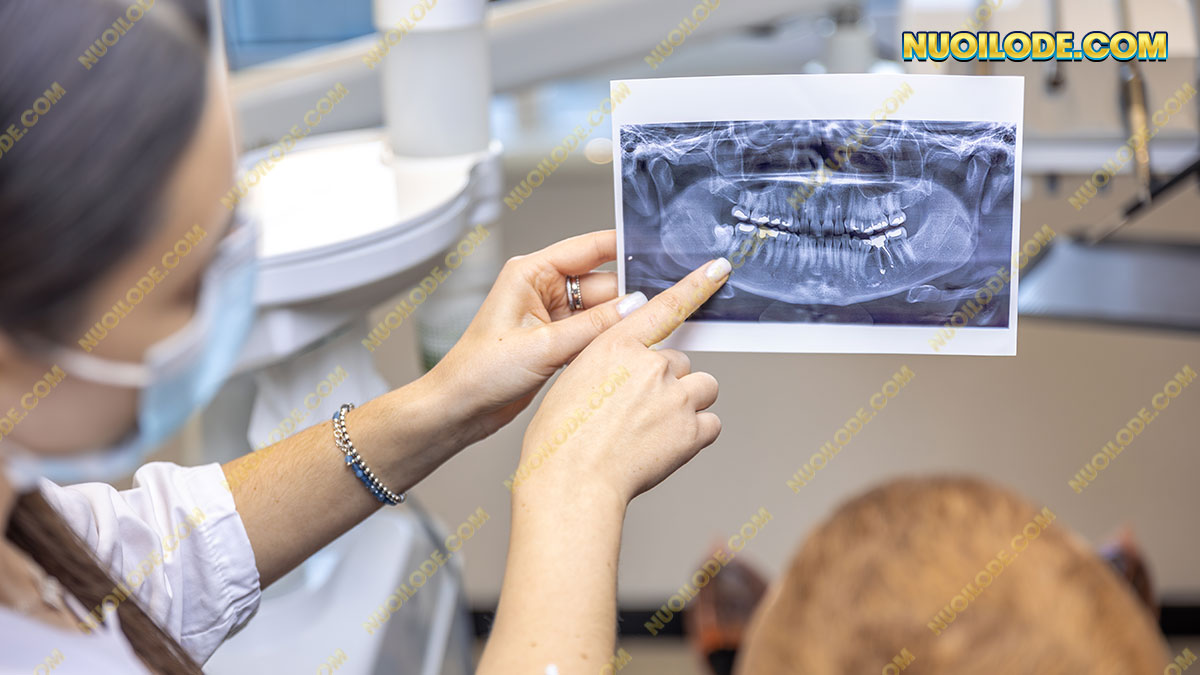 Mơ thấy rụng răng đánh lô đề con gì dễ trúng?